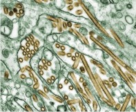 A5N1 virus